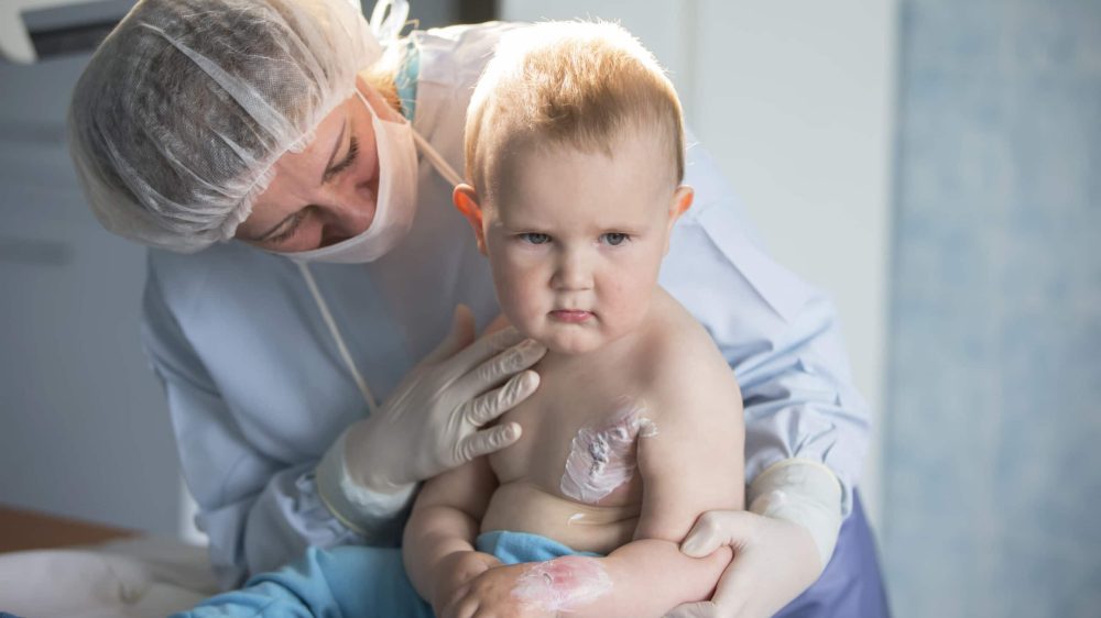 Belarus, the city of Gomel. City Burn Hospital. June 02, 2017. A little boy nurse treats a burn. A child in the hospital is injured. The doctor treats the baby. Little hospital patient.